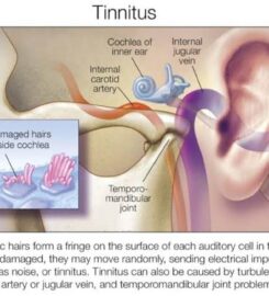 Hope Ear Nose and Throat Clinic